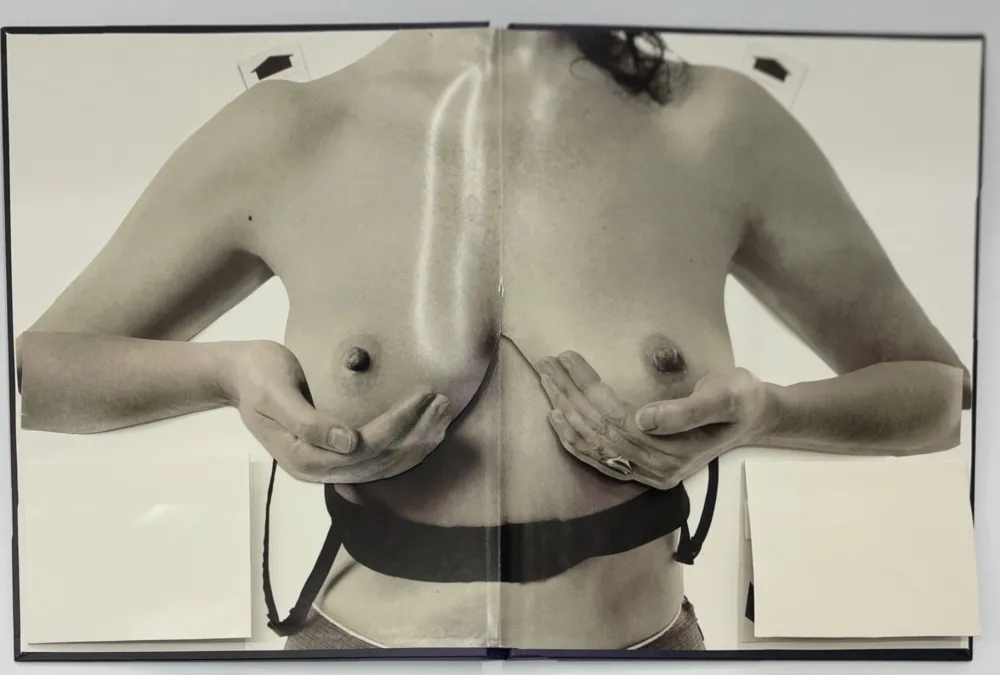 摄影 Calle - Les seins miraculeux (Beautiful breasts)