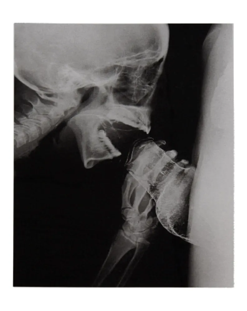 插图书 Delvoye - Sexrays