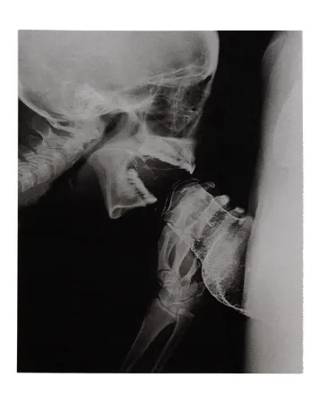 插图书 Delvoye - Sexrays