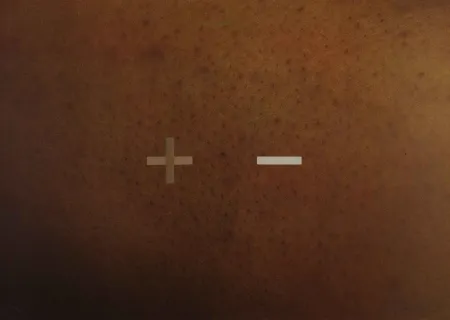 丝网印刷 Dias - S.T.