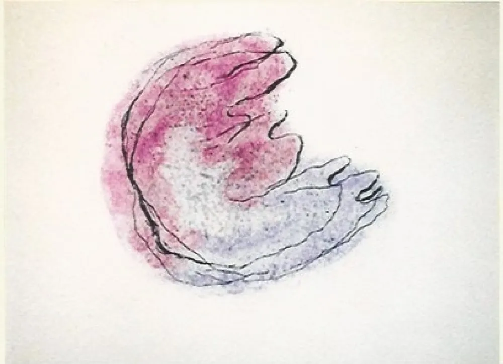 版画 Fautrier - Baby mine