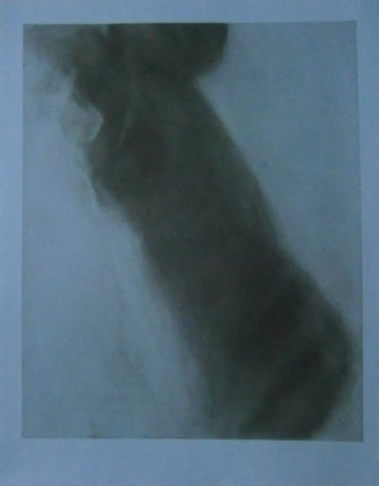 蚀刻版画 Garache - Bleue