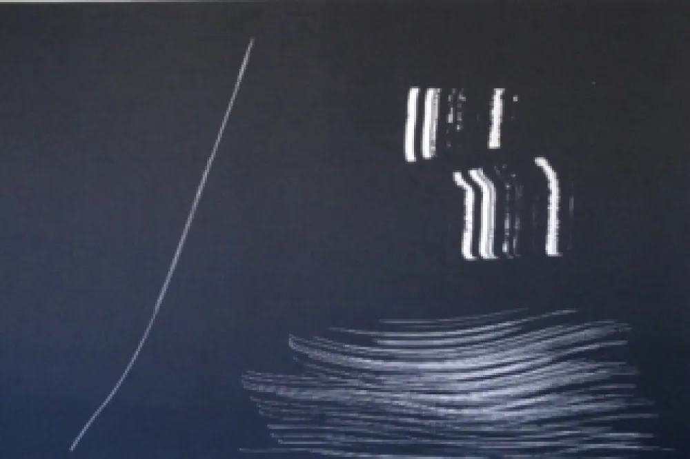 石版画 Hartung - Farandole 9