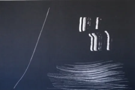 石版画 Hartung - Farandole 9