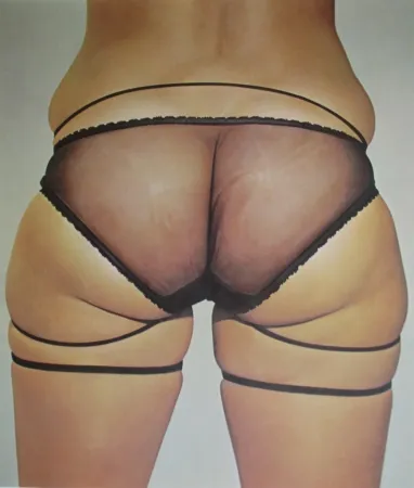 石版画 Kacere - Loretta 