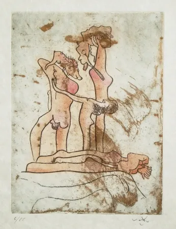 蚀刻飞尘法 Matta - FMR