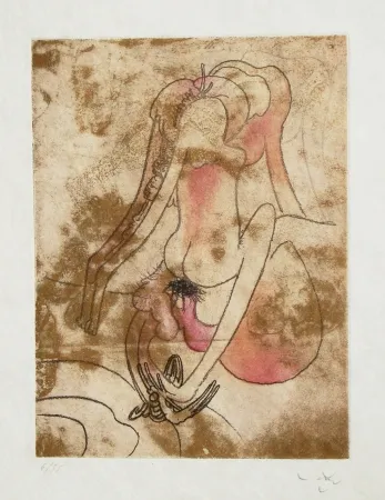 蚀刻飞尘法 Matta - FMR