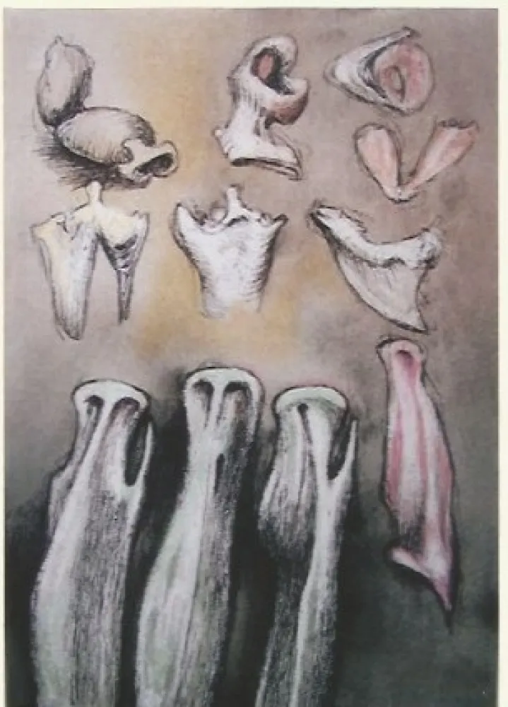 石版画 Moore - Tree sisters